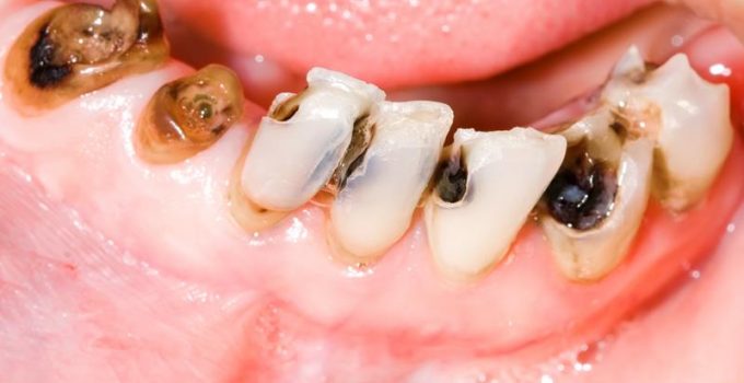 Noblet Cosmetic & Family Dentistry |