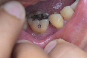 Noblet Cosmetic & Family Dentistry |