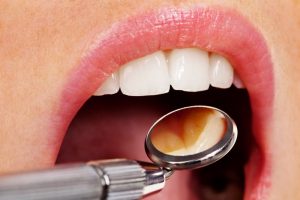 Noblet Cosmetic & Family Dentistry |
