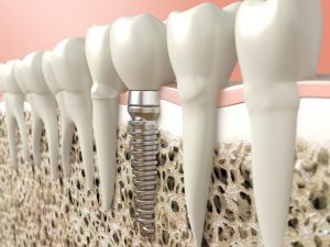 Noblet Cosmetic & Family Dentistry |
